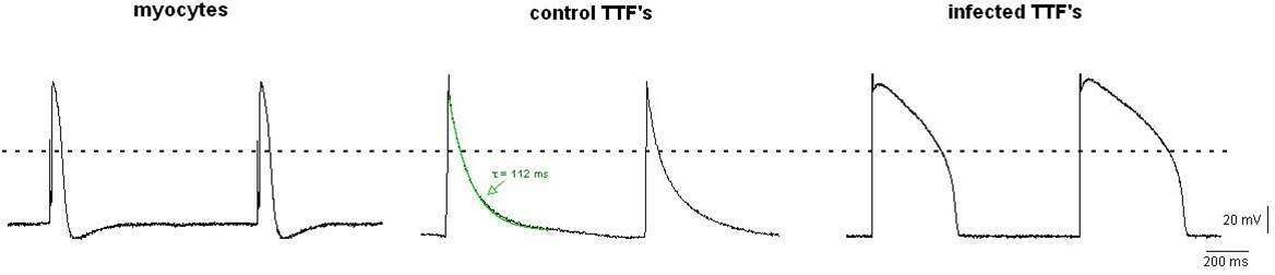 Response of CM, wild-type and reprogrammed fibroblasts to depolarizing stimulus